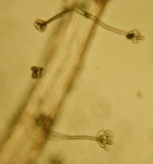 The black mould fungus, Stachybotrys chartrum