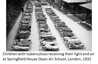 Children with tuberculosis receiving their light and air at Springfield House Open Air School, London, 1932