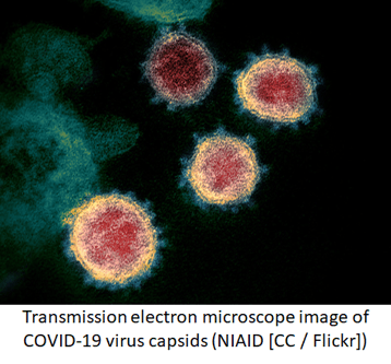 Transmission electron microscope image of COVID-19 virus capsids (NIAID [CC / Flickr])