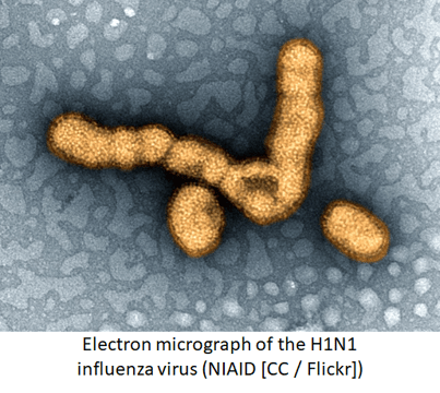 Electron micrograph of the H1N1 influenza virus